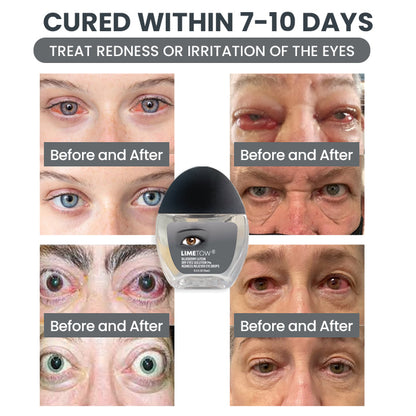 LIMETOW® Redness-Relief Eye Drops