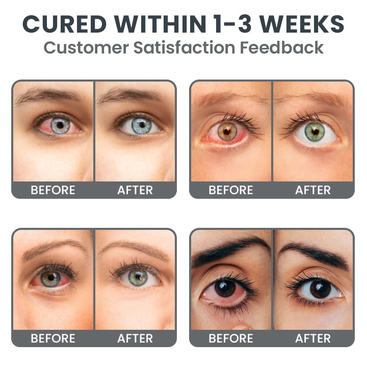 LIMETOW® Redness-Relief Eye Drops