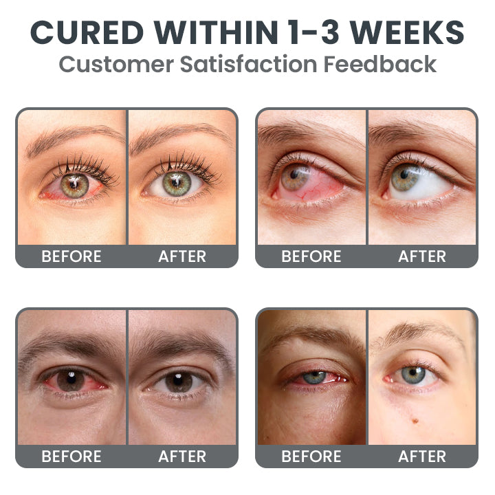 LIMETOW® Redness-Relief Eye Drops