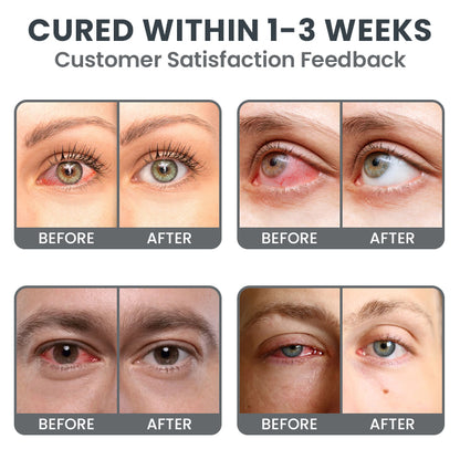 LIMETOW® Redness-Relief Eye Drops